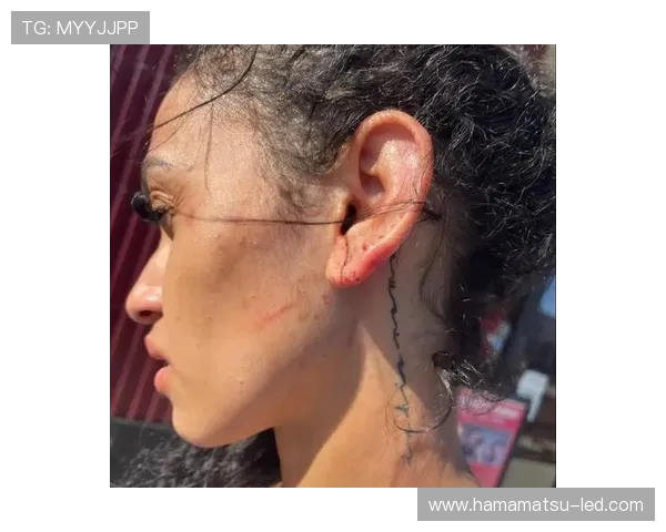 布里奇斯否认家暴指控 称前女友伤疤为痘痘和丰唇失败所致 布里奇斯否认家暴指控 称前女友伤疤为痘痘和丰唇失败所致